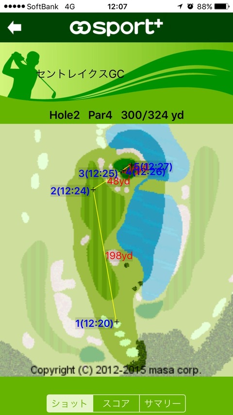 S__31858690