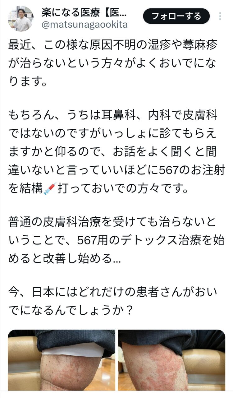 【画像】コロナワクチン、やっぱりヤバイwwwwww