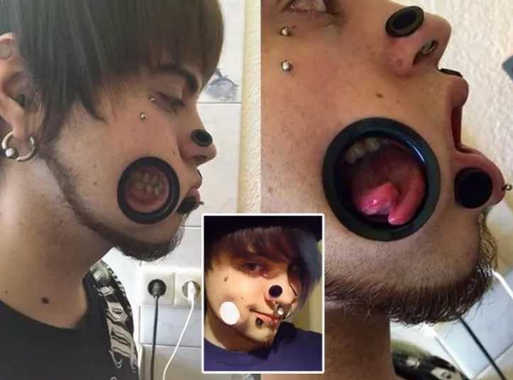 閲覧注意】ほっぺたに巨大なピアスを開けた男性\u2026もしやドイツで
