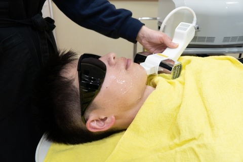 ヒゲ脱毛して後悔したこと教えるわｗｗｗｗｗ