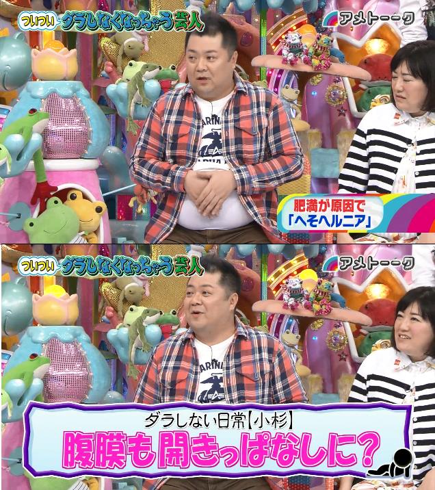 ブラマヨ小杉さん 太りすぎで腹膜が裂けてしまった内臓飛び出てるんです デブって自制できないのか 日本の憂鬱 厳選ニュース 2chまとめ ブラマヨ小杉さん 太りすぎで腹膜が裂けてしまった内臓飛び出てるんです デブって自制できないのか 日本の憂鬱 厳選ニュース 2chまとめ