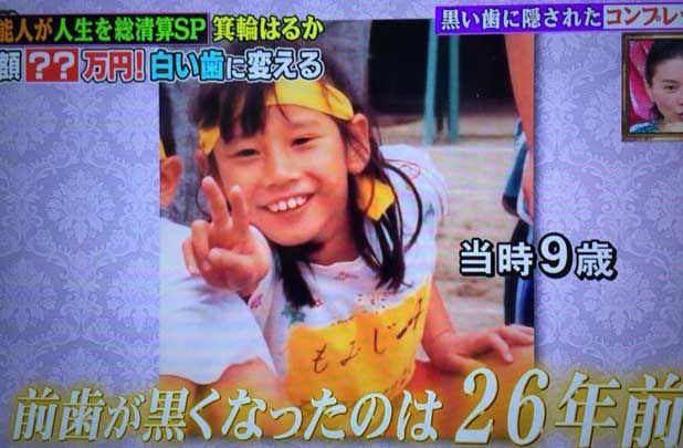 ハリセンボン箕輪はるかが歯を白くした結果wwwwwwww 堀北真希さんに似てきましたよね Newsまとめんばー ハリセンボン箕輪はるかが歯を白くした結果wwwwwwww 堀北真希さんに似てきましたよね Newsまとめんばー