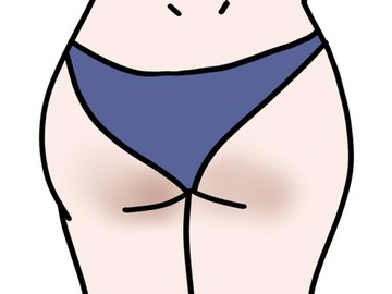 990