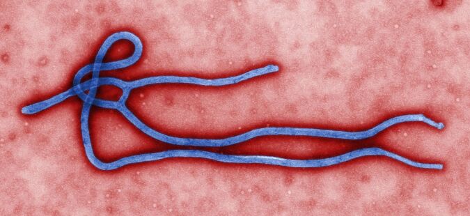 【エボラ】 コンゴ民主共和国で感染5000人超、犠牲者2300人以上