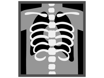 roentgen_satsuei_11684