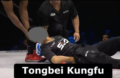 【悲報】 中国伝統武術「通背拳」の継承者がパワースラップ大会に出場、意識を失い頬骨骨折