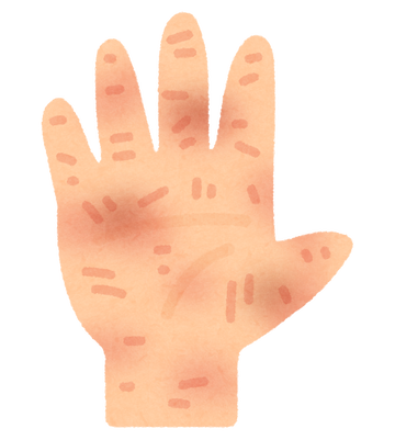 body_hand_areru