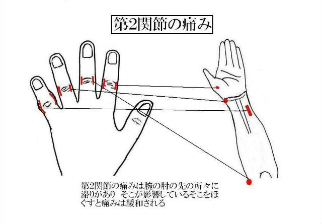 尺側手根屈筋 バーリトゥード日記 尺側手根屈筋 バーリトゥード日記