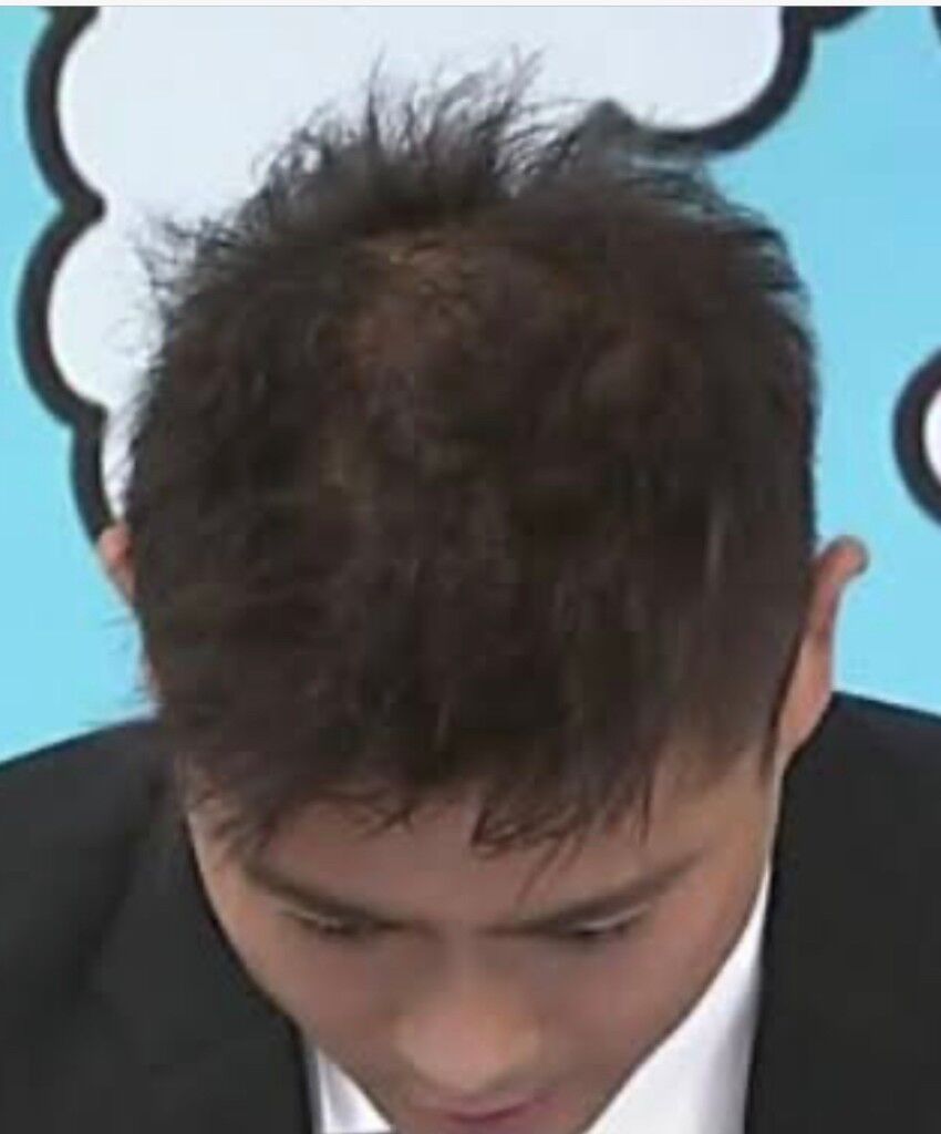 芸能 山口達也 Tokioファンの 悲鳴 と同時に上がった 頭皮 を心配する声 はと フォーエバー 速報 気になる噂の芸能ニュース