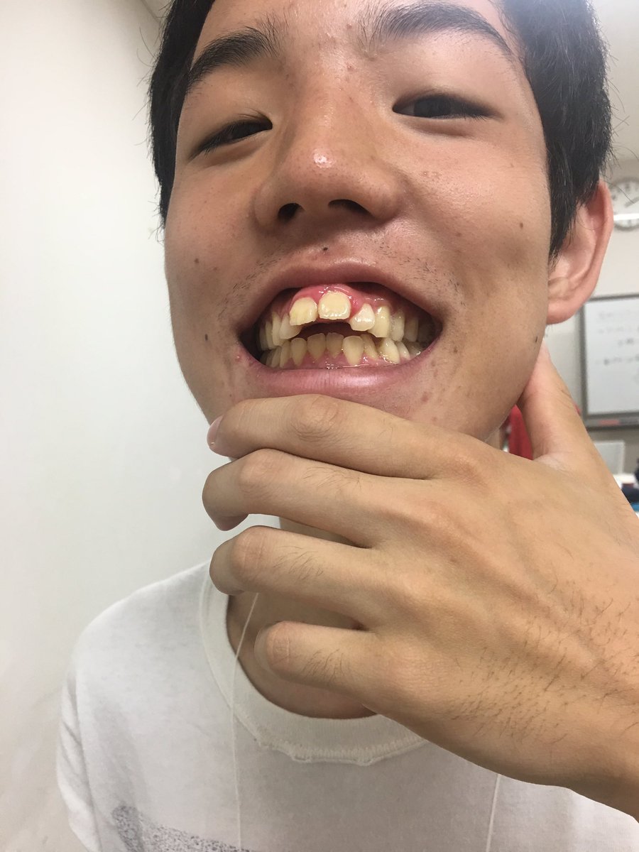芸能人の歯が気になるわ 速報 気になる噂の芸能ニュース 芸能人の歯が気になるわ 速報 気になる噂の芸能ニュース