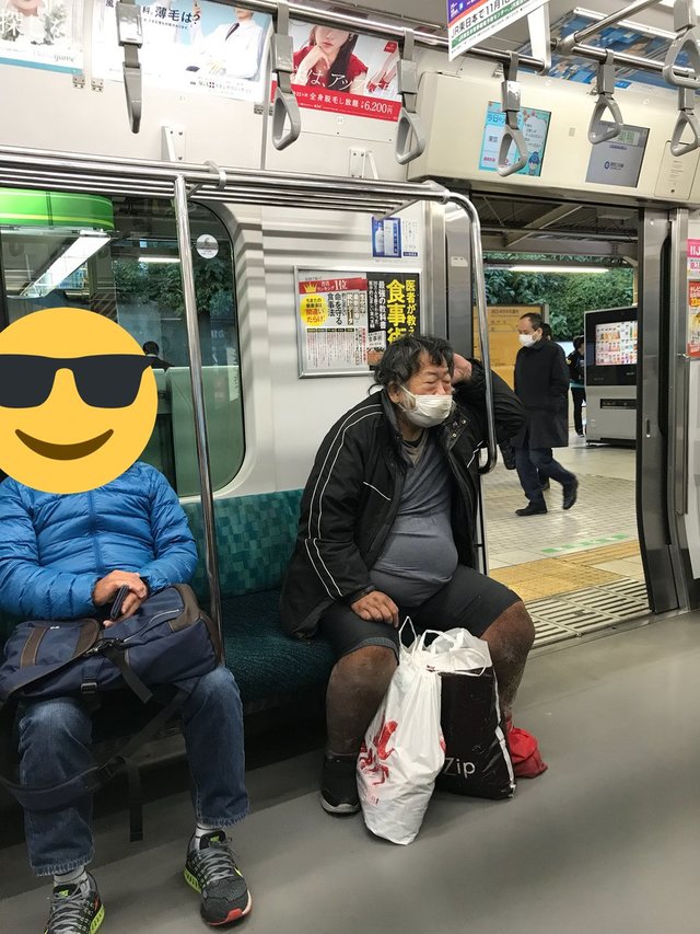画像あり 左足壊死ニキ 右足もヤバくなる 画像あり 左足壊死ニキ 右足もヤバくなる