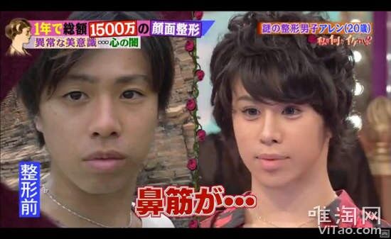 朗報 男も整形でここまで超イケメンに変われる まとめウォッチ速報 朗報 男も整形でここまで超イケメンに変われる まとめウォッチ速報