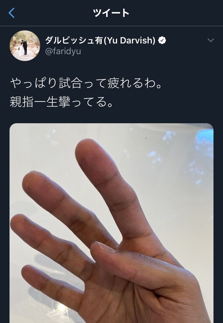 悲報 手だけでヤバい奴と分かるなんj民現る まとめウォッチ速報