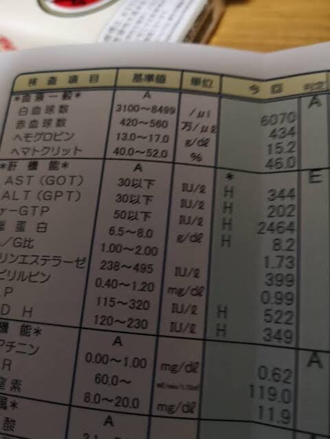 なんj民 G Gtpが基準値超えたw ワイは100 200超えたことある まとめウォッチ速報