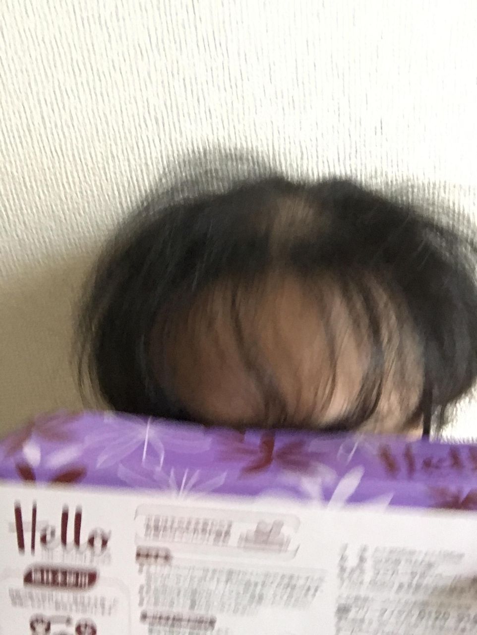 若ハゲの辛さは異常 そぴえんす速報 若ハゲの辛さは異常 そぴえんす速報