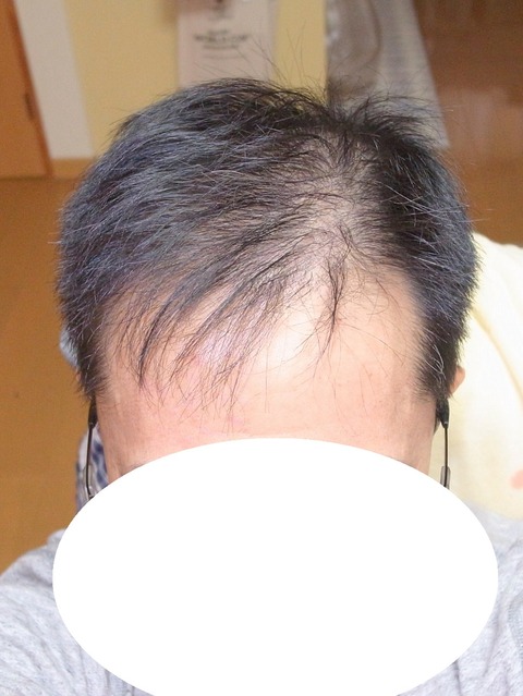 R0013737
