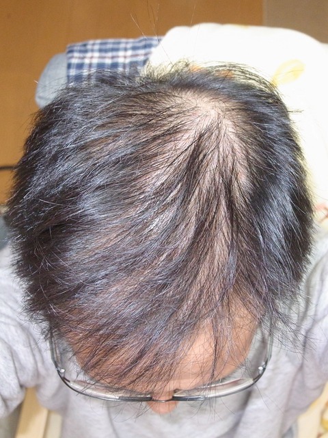 R0013740