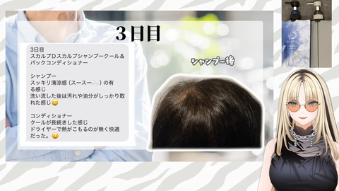 【㊙ニコ父頭皮写真㊙】スカルプD、ニコ父ガチレビュー!【虎金妃笑虎】 22-9 screenshot