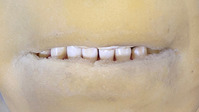 teeth4