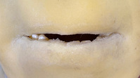 teeth3