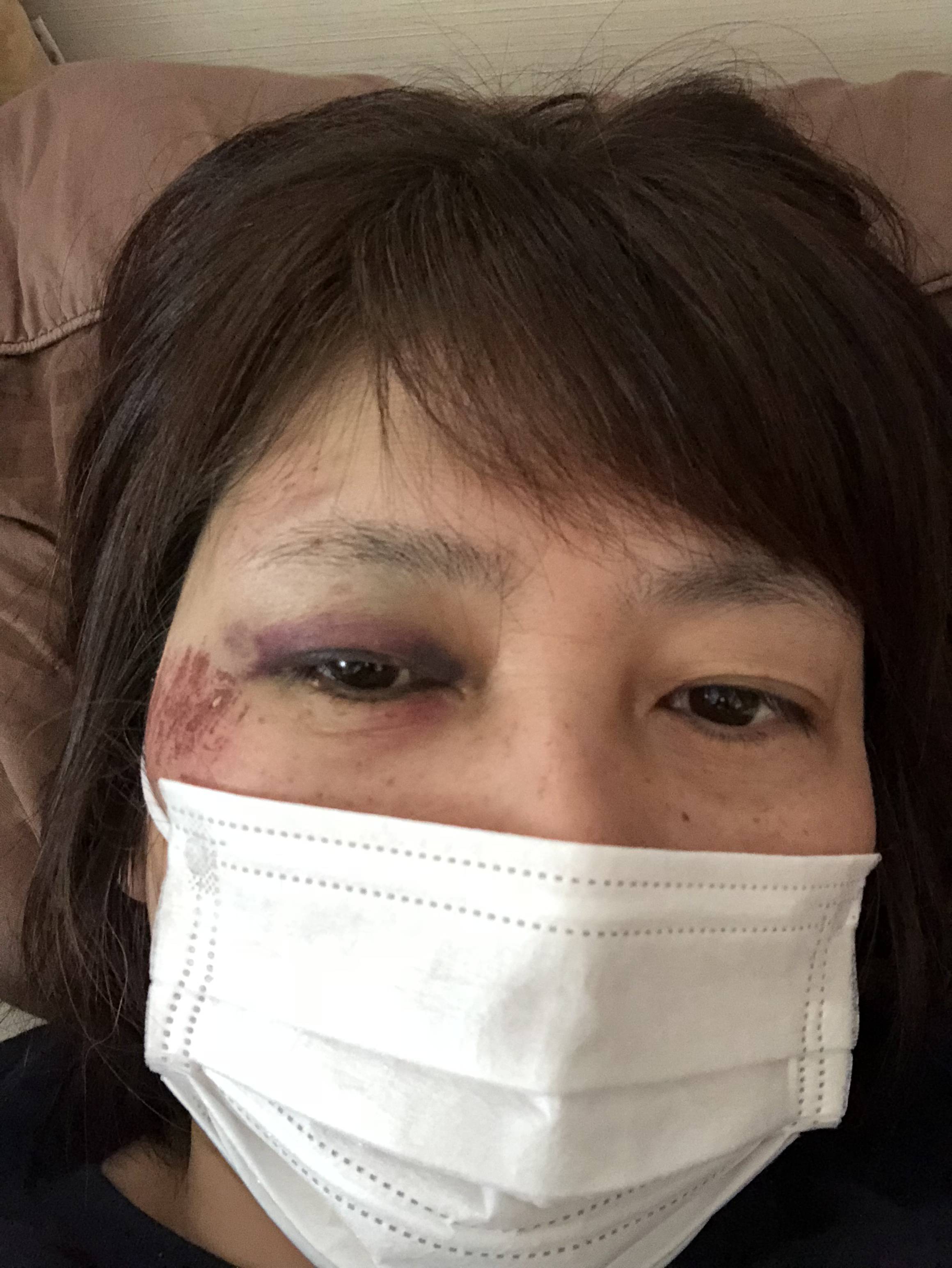 打撲してる間に桜の開花が終わったー 我家記