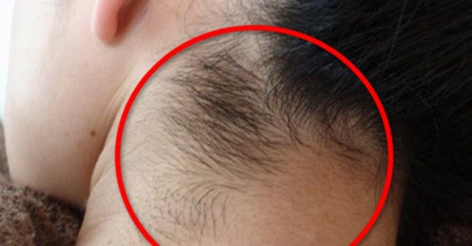 女性なのに毛深いのには原因があった 女性なのに毛深いのには原因があった