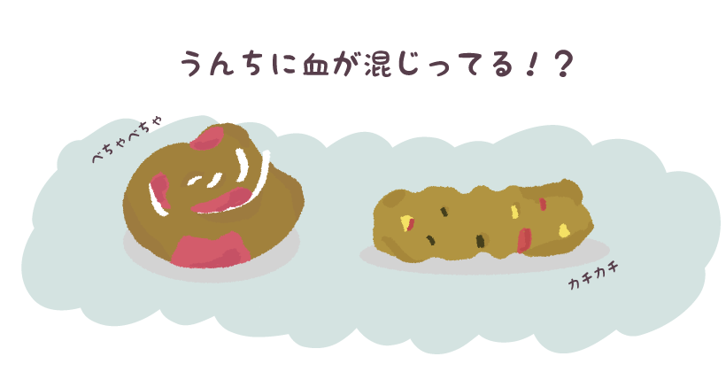 血便が出てしまいました まとめて面倒見させて頂きます 血便が出てしまいました まとめて面倒見させて頂きます