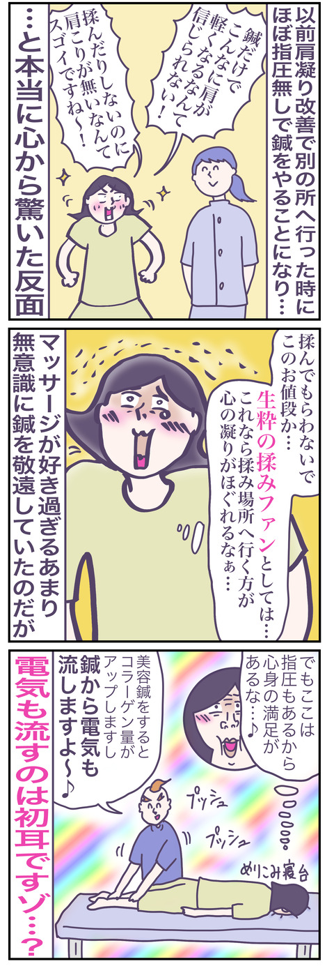 美容鍼3い