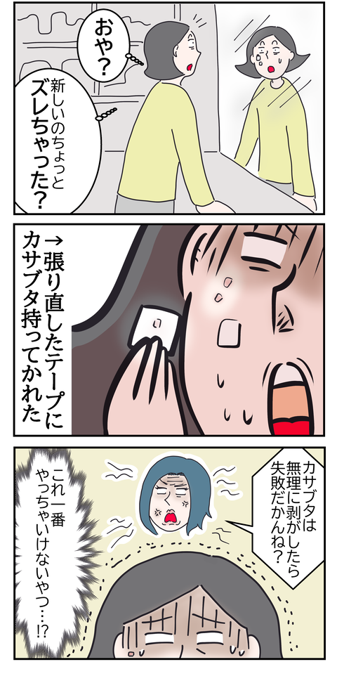 シミ取り8い