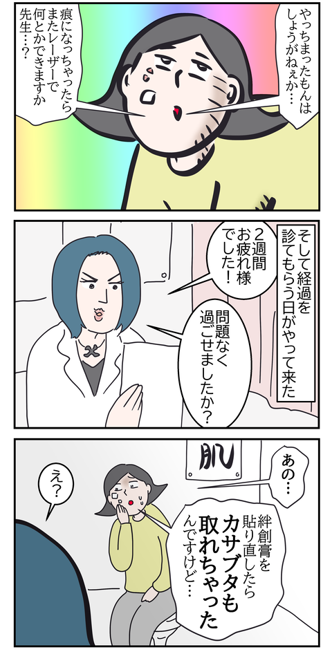 シミ取り9い