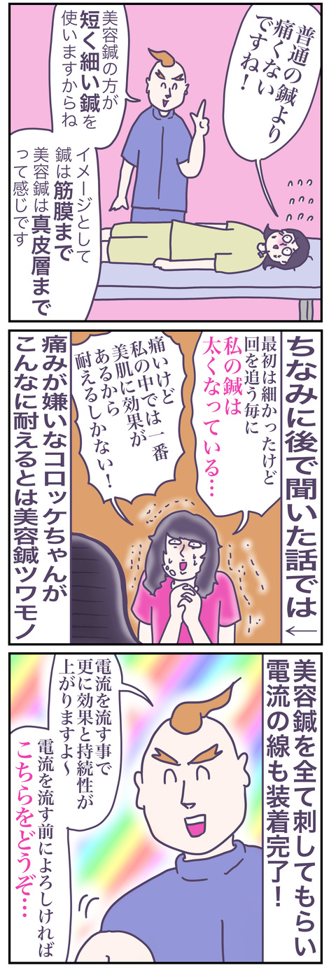 美容鍼4い