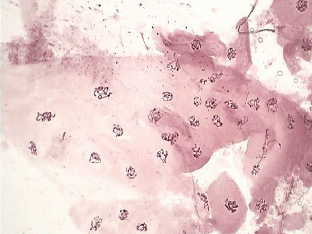 アカムシの唾液腺染色体の観察 Web247 アカムシの唾液腺染色体の観察 Web247