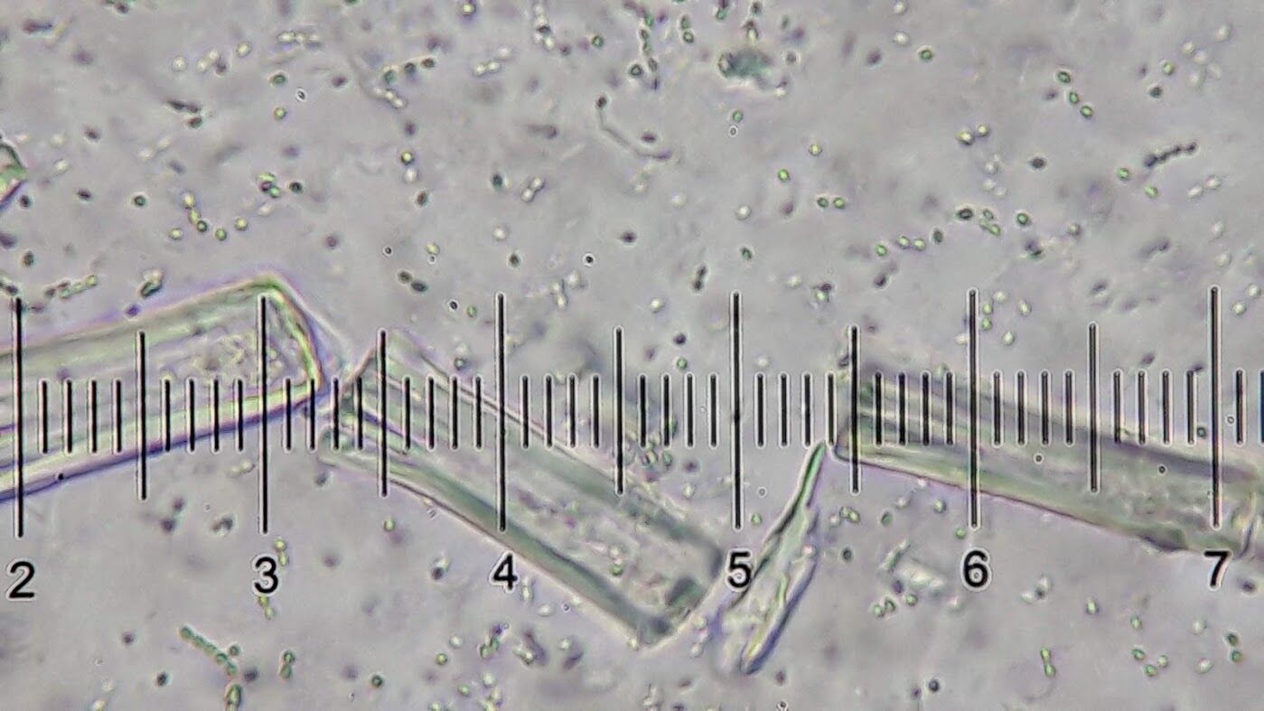 納豆菌を見てみよう 3 知らぬが仏 Web247 納豆菌を見てみよう 3 知らぬが仏 Web247