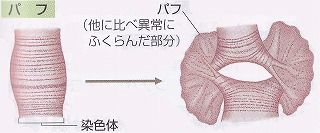 アカムシの唾液腺染色体の観察 Web247 アカムシの唾液腺染色体の観察 Web247