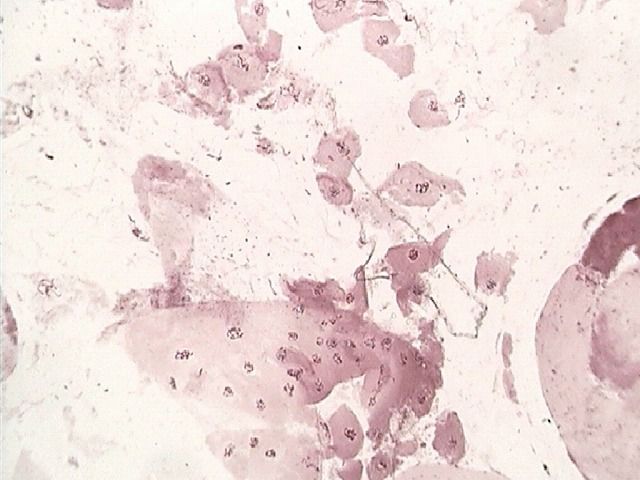アカムシの唾液腺染色体の観察 Web247