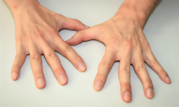 白バイに追われ電柱ワイヤに激突 バイク男性 上半身切断 Tsf Guitar Carパーツクラフト工房