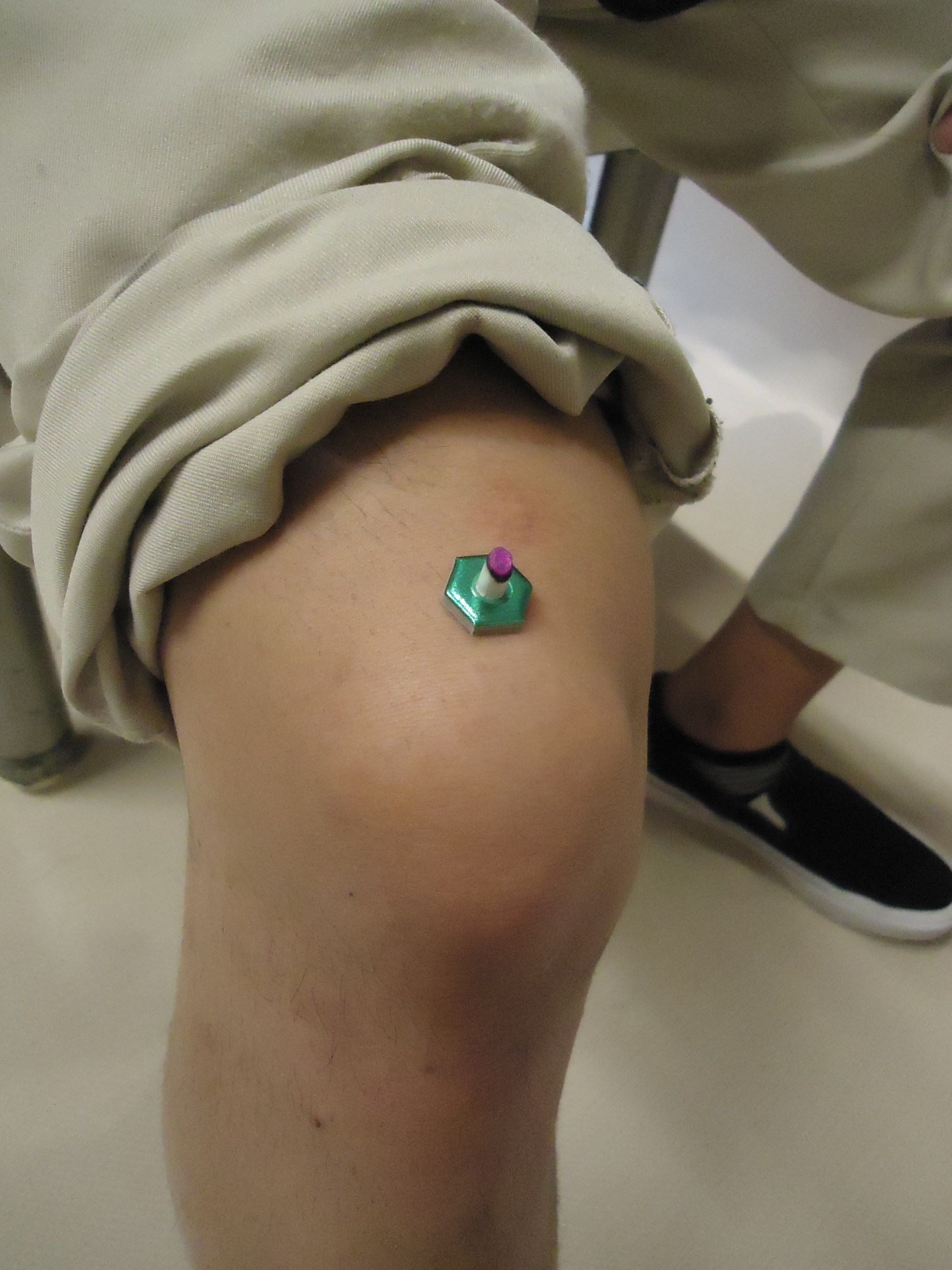 今月のツボのお話 地域の皆様を支えるウェルフェアmoeのいいことblog