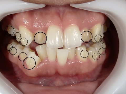 S__48160788