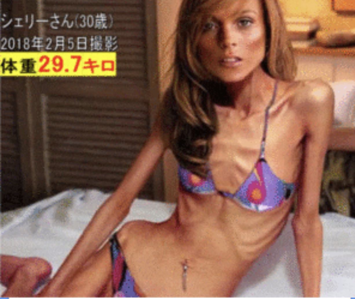 痩せ薬の広告の人ガリガリで草 ダイエットブログ 痩せ薬の広告の人ガリガリで草 ダイエットブログ