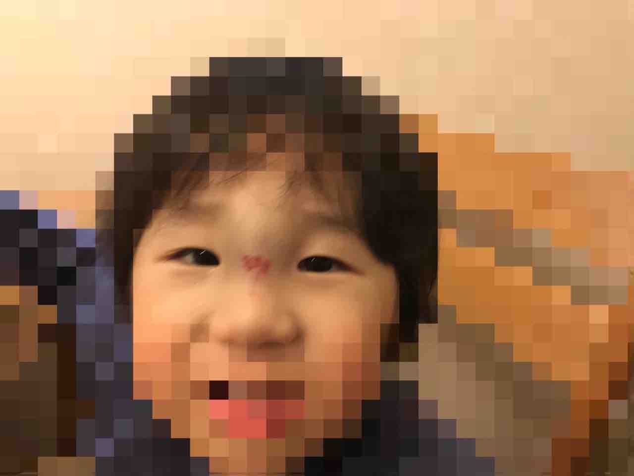 お店で子供が頭をぶつけた時の対処法と病院に連れていくべき症状 ぶつけさせない為の対策方法 お家が一番