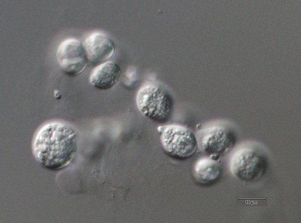 800px-Aurantiochytrium_limacinum_SR21