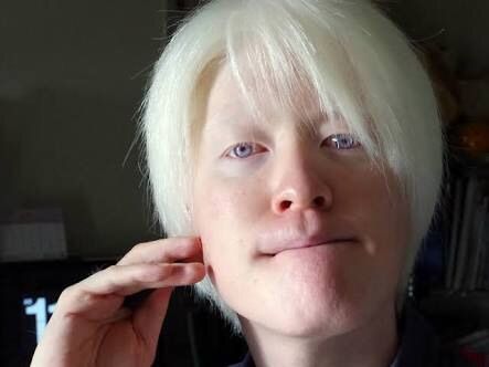 トップ 100 オッドアイ 日本 人 青い 目 東北 サンセゴメ