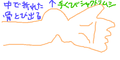 1hg3e