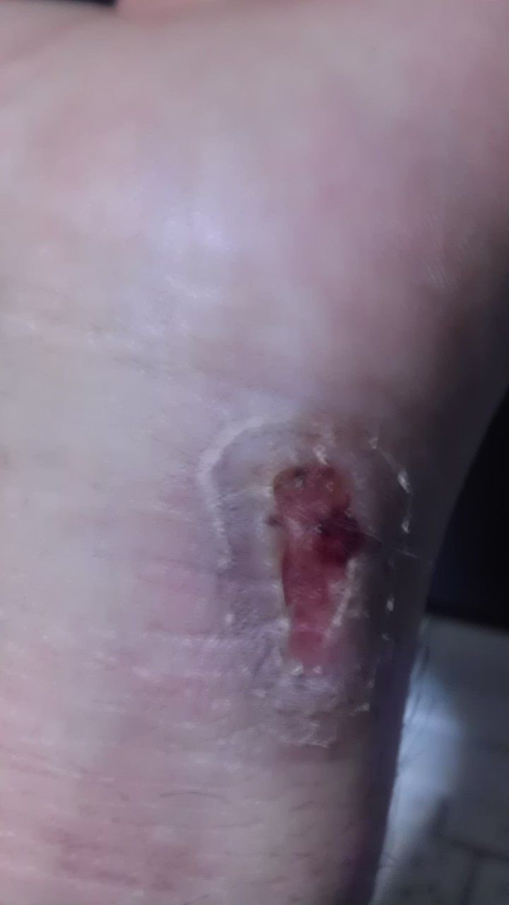 閲覧注意 親友に呪詛かけたったｗｗｗｗｗ 不思議 Net