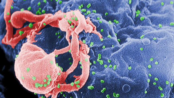 082520_TI_HIV-blood_feat-1028x579