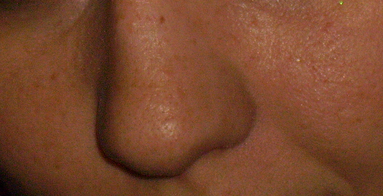 ワールドワイド奥さん 毛穴 角栓 取り方 検索するの何回目