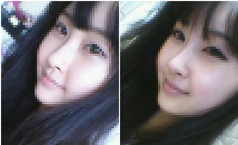 韓国ウィンクリニック 鼻プチ整形 ヒアルロン酸 韓国美容皮膚科abijouクリニック