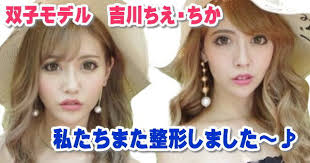 やばたんまとめ 恐怖 双子モデルyoutuber ちえちか さんが 整形のデメリット を公開wwwww Livedoor Blog ブログ やばたんまとめ 恐怖 双子モデルyoutuber ちえちか さんが 整形のデメリット を公開wwwww Livedoor Blog ブログ