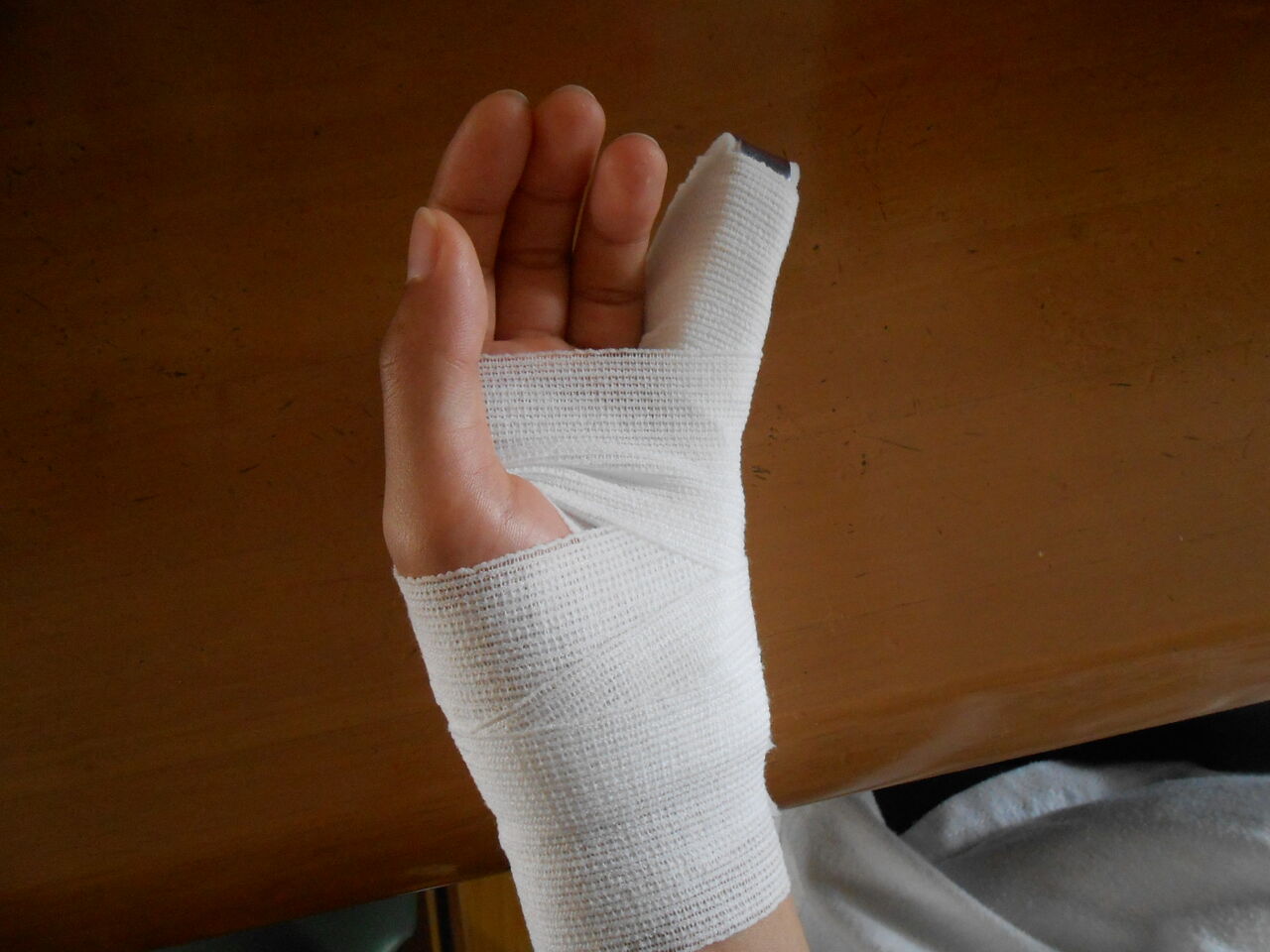 次女 骨折する Yamatarobligのblog