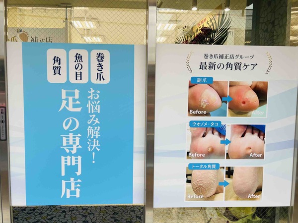 大和駅ちかくに「巻き爪補正店」ができてる